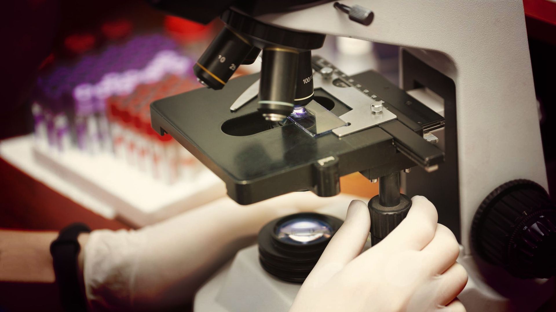 veterinary worker in gloves using microscope for testing blood samples of animals